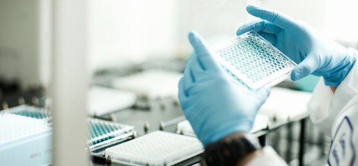華中農(nóng)業(yè)大學New Phytologist解析番茄類胡蘿卜素調控