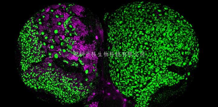 北大學(xué)者eLife發(fā)文：神經(jīng)祖細(xì)胞命運鎖定，防止腦腫瘤發(fā)生新機(jī)制
